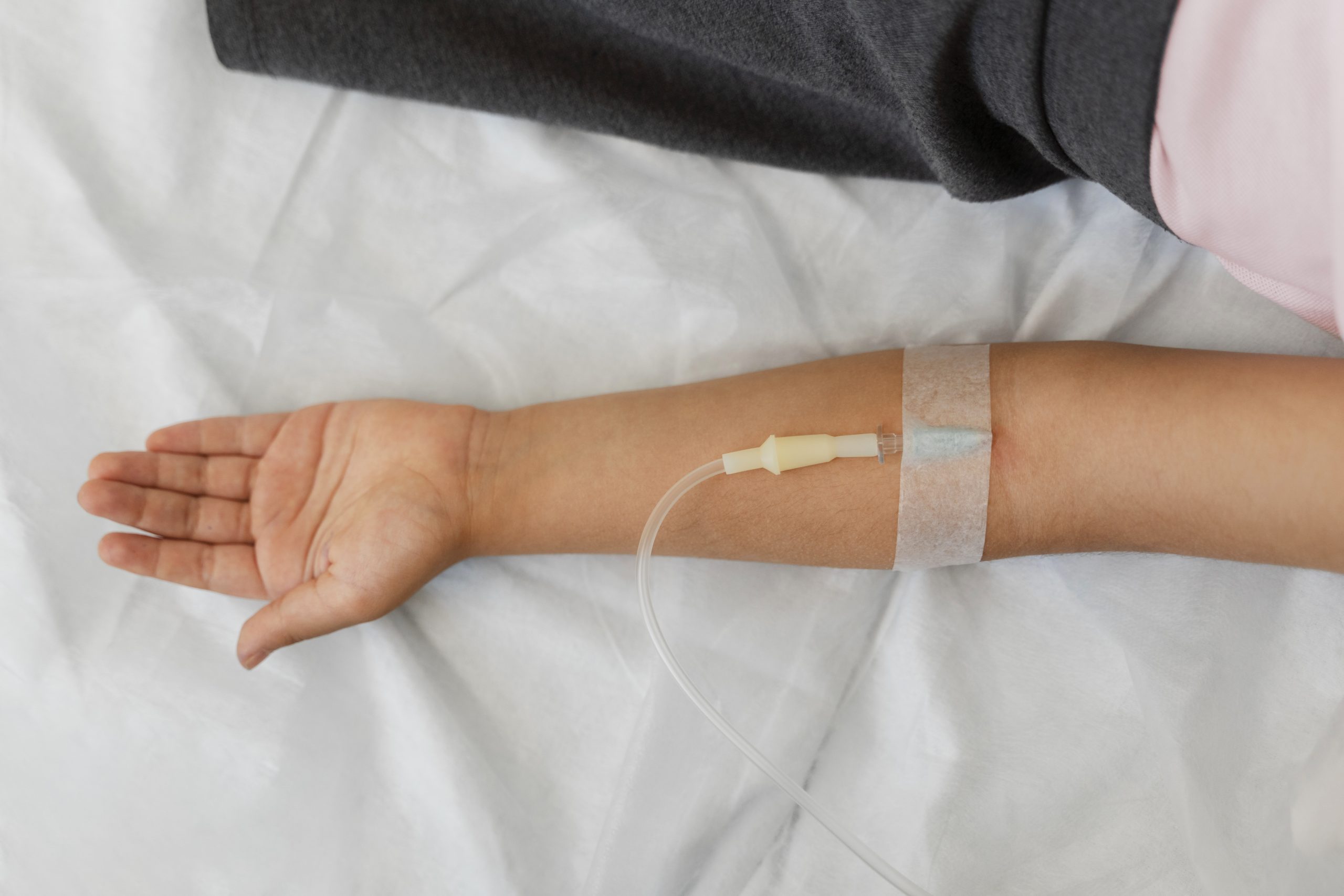 left forearm with palm open and IV inserted