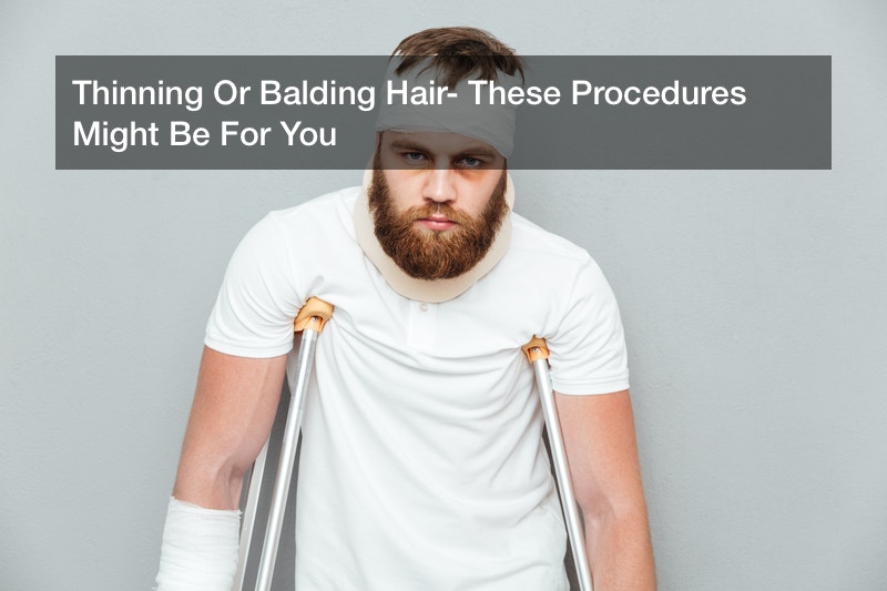 Thinning Or Balding Hair? These Procedures Might Be For You