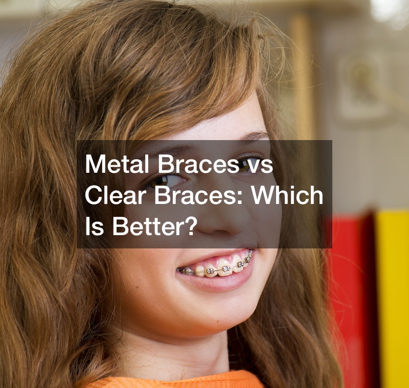 Metal Braces vs Clear Braces Which Is Better?