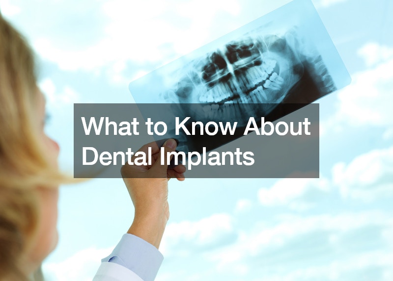 What to Know About Dental Implants