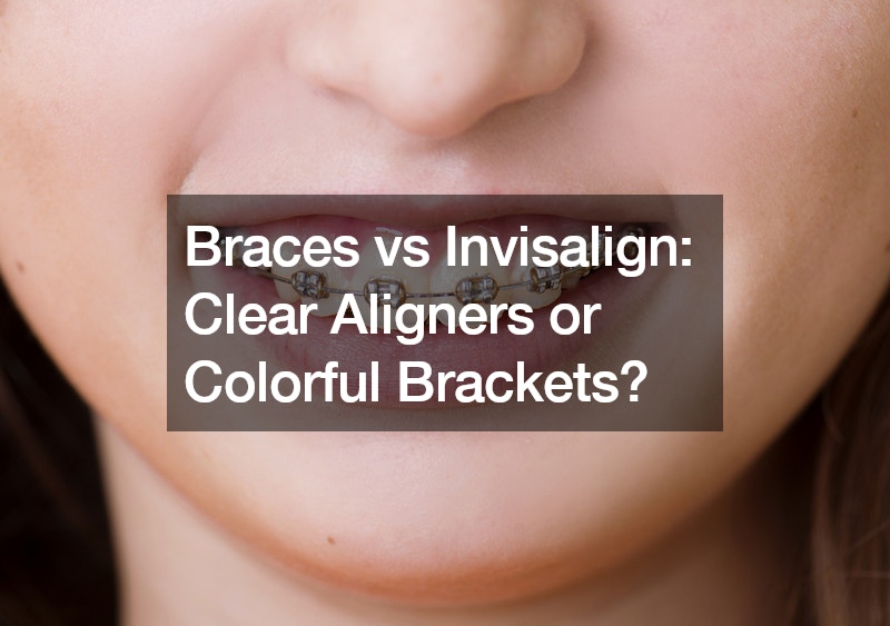 Braces vs Invisalign Clear Aligners or Colorful Brackets?